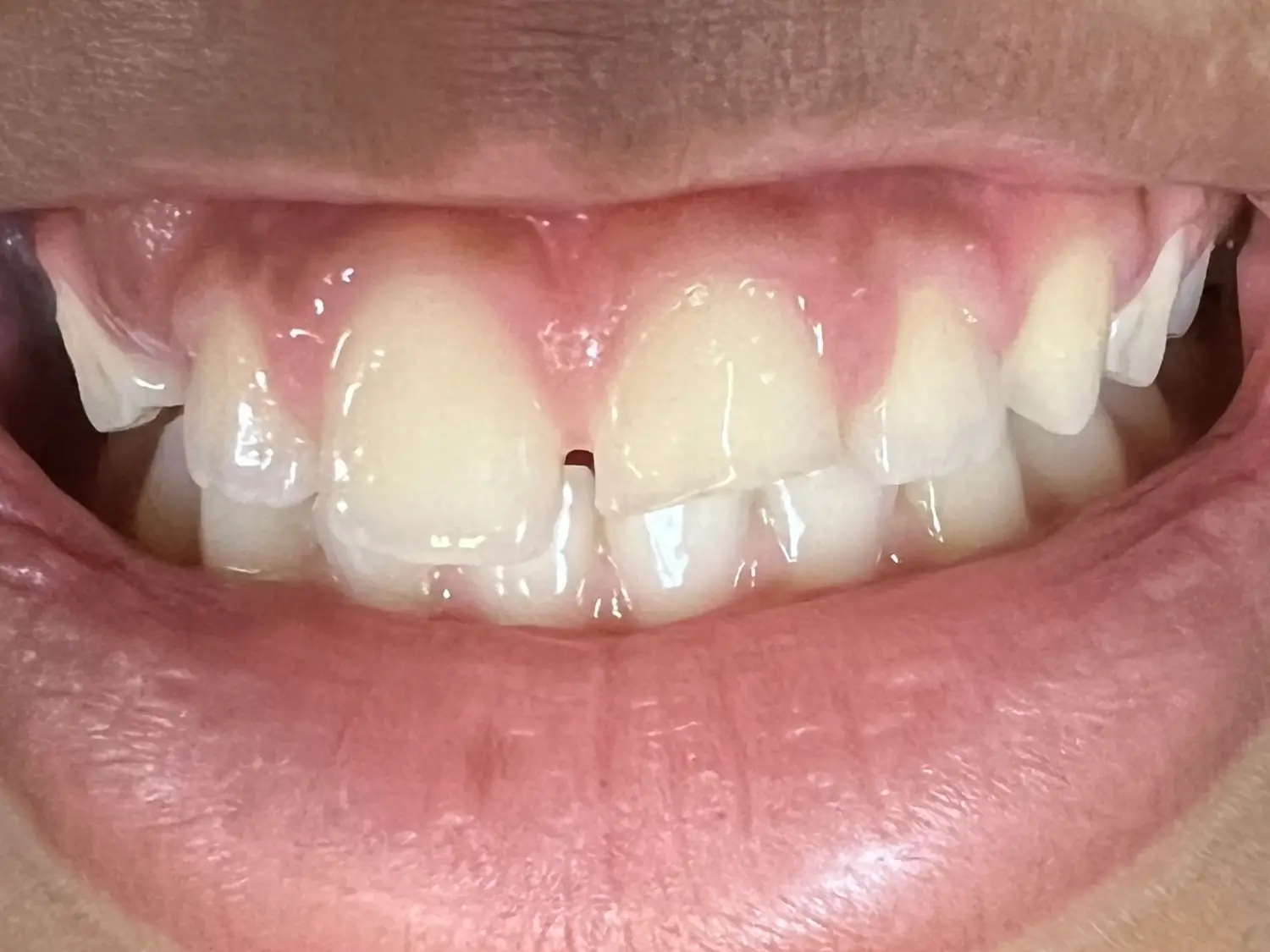 before image
