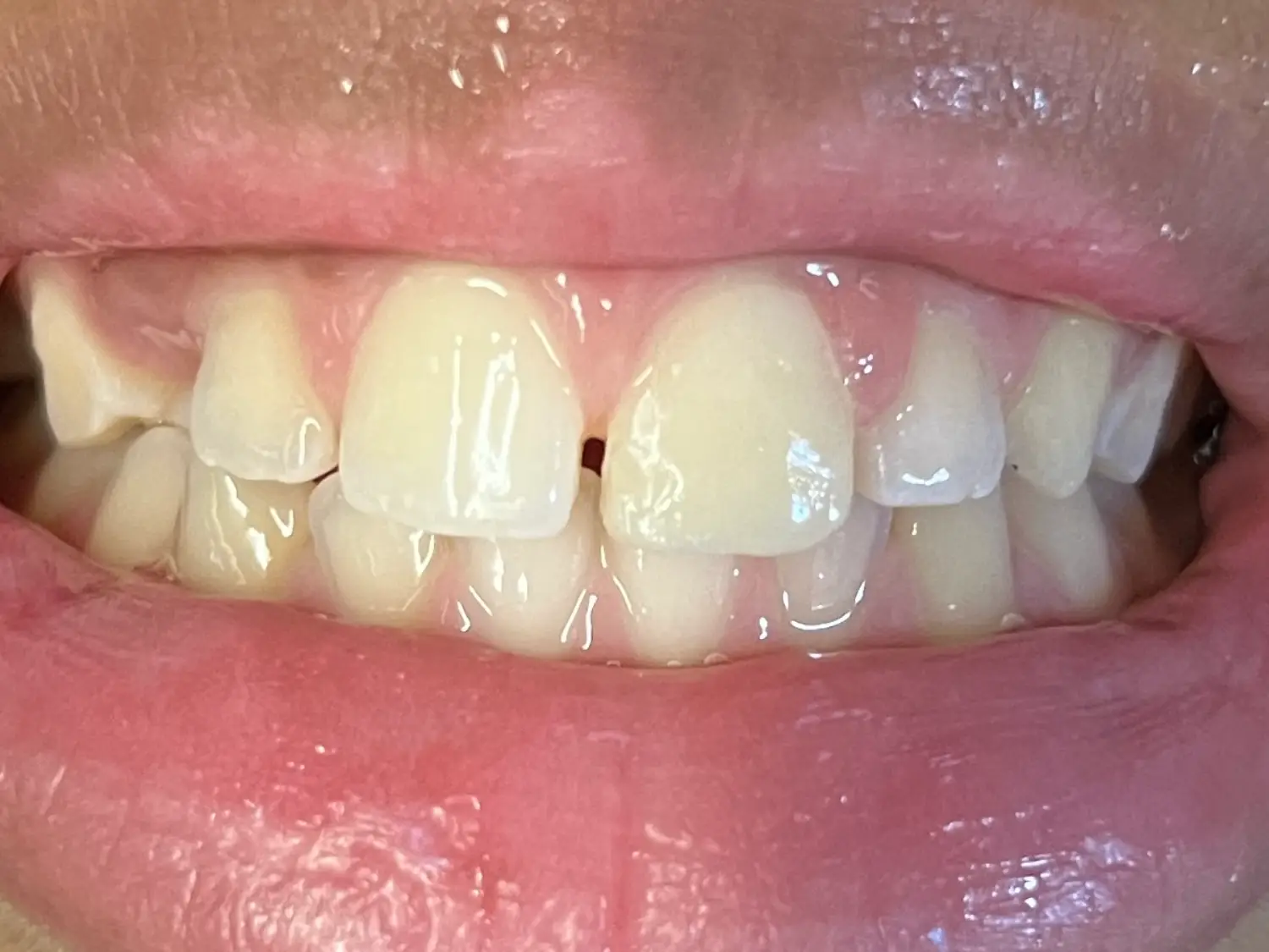 after image