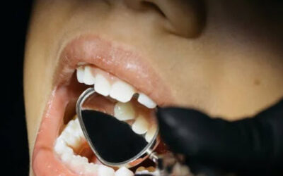 Building Bright Smiles: Why Preventive Pediatric Dentistry Is the Key to Lifelong Oral Health in Newton