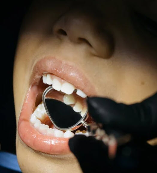 kid at dentist (2)